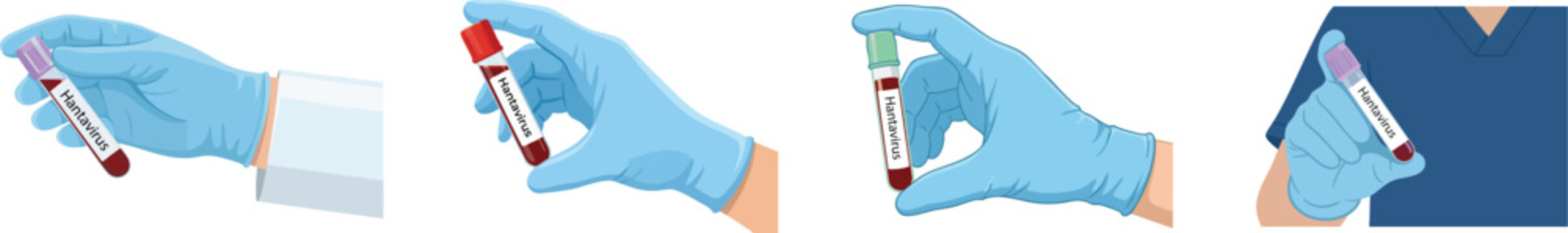 Medical sample collection process with gloved hands syringe test tube gloves, Hantavirus