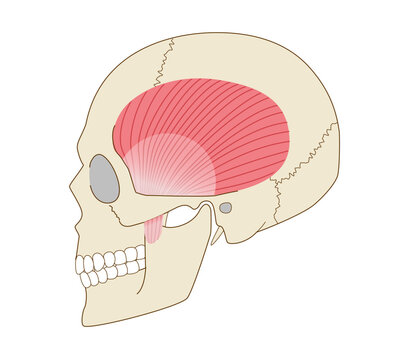 Anatomical illustration of the temporalis muscle and skull viewed from the side (muscle involved in chewing force)
