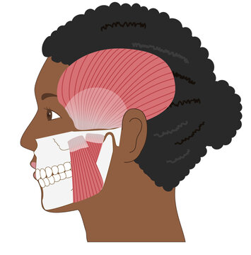 Anatomical illustration of a Black woman&rsquo;s profile with overlapping jawbone and masticatory muscles