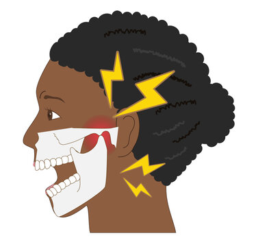 Anatomical illustration of a Black woman&rsquo;s profile suffering from jaw pain and temporomandibular disorder