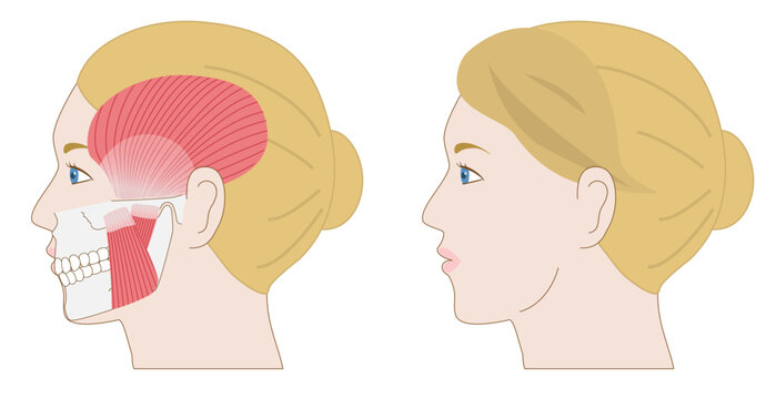 Comparison set of anatomical illustrations of a White woman&rsquo;s profile with overlapping jawbone and masticatory muscles