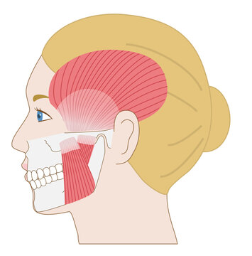 Anatomical illustration of a White woman&rsquo;s profile with overlapping jawbone and masticatory muscles