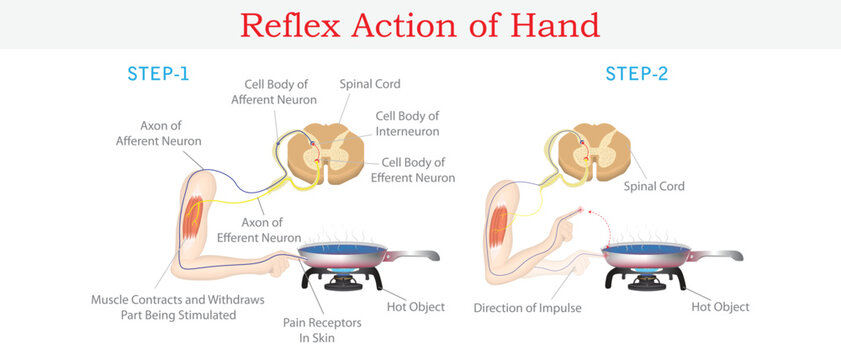 Reflex Action of Human Hand Showing Neural Pathway and Withdrawal Response to Hot Object Medical Illustration.
