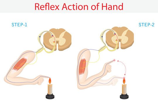 Reflex Action of Human Hand Demonstrating Spinal Reflex Response and Withdrawal from Heat Stimulus Medical Illustration.