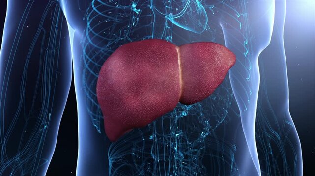 Digestive system diseases: cirrhosis, hepatitis, fibrosis, malignancy, liver failure, and viral infection progress to hepatocellular carcinoma. 3D animation of liver pathology.