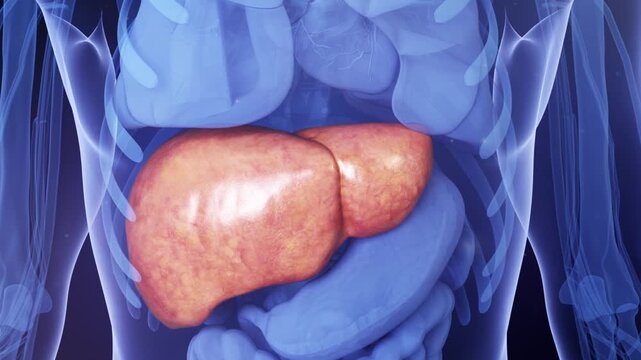 Liver lesions, cirrhosis, hepatitis, and viral infection progress to fibrosis, malignancy, and liver failure. X-ray visualization of hepatocellular carcinoma. 3D animation of digestive system disease.