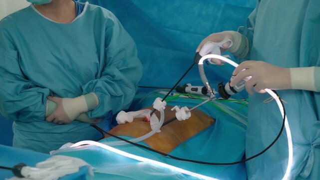 Laparoscopic cholecystectomy instrument. The surgeon's doing laparoscopic gastric sleeve surgery