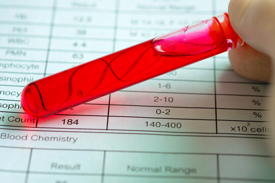 stock market chartMedical technician in blue glove holding blood sample test tube over patient clinical report, laboratory blood test for health checkup and diagnostic screening in hospital or clinic.