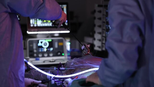 4k video. laparoscopic surgery. Surgeons performing a laparoscopic surgery using minimally invasive tools and high-tech monitoring equipment in a modern operating room. tumor cancer removal surgery