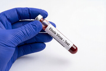 Fototapeta na wymiar Gloved hand presenting test tube with ebola virus blood sample for testing