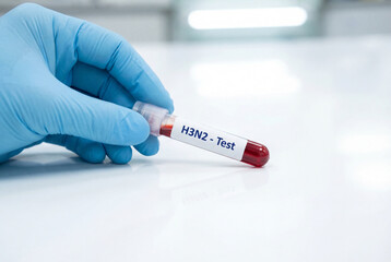 Obraz premium Gloved hand holds test tube with red blood sample for h3n2 virus test
