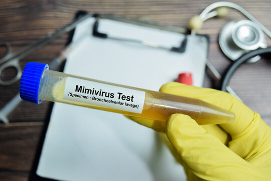 Mimivirus Test with blood sample in yellow gloved hands. For DNA virus, agent of human respiratory disease