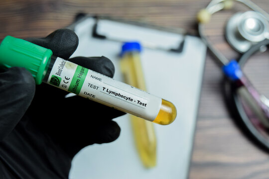 T lymphocyte Test with blood sample in black gloved hands. They are key components of the adaptive immune system, protecting the body from infections