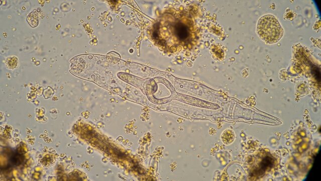 Microscopic view of a rotifer, highlighting its distinct anatomy and translucent body structure