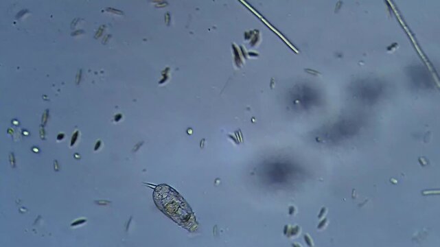 Paramecium - Micro organism at microscope magnification