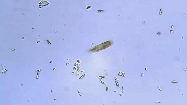 Paramecium - Micro organism at microscope magnification