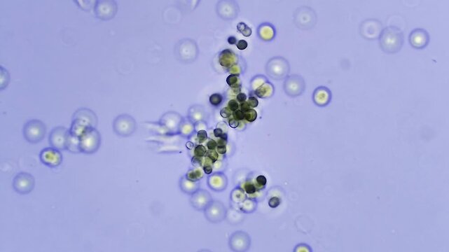 Algae - Micro organism at microscope magnification