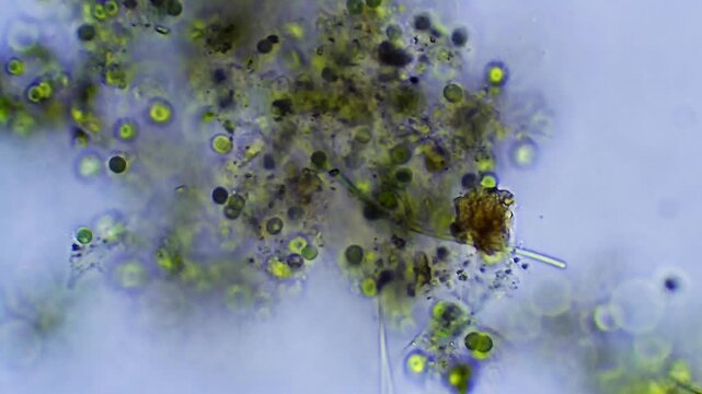 Algae - Micro organism at microscope magnification