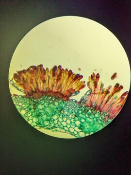 Puccinia graminis telia, on wheat on a microscope