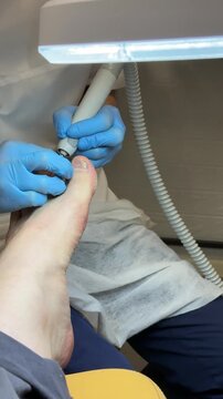 Close-up foot pedicure salon, master uses diamond drill on male foot wearing blue gloves, callus removal around heel and toes