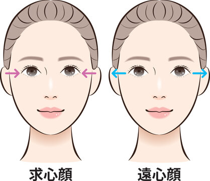 求心顔と遠心顔の比較イラストセット（説明矢印つき）