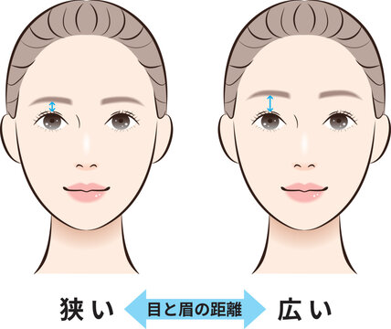 目と眉の距離（狭い・広い）比較イラスト　解説矢印つき