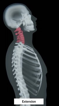 Video of Neck extension is the backward bending movement of the head and cervical spine, allowing the face to tilt upward with effective area