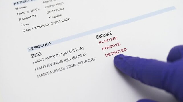 Doctor's finger pointing at a positive hantavirus test result on a medical report