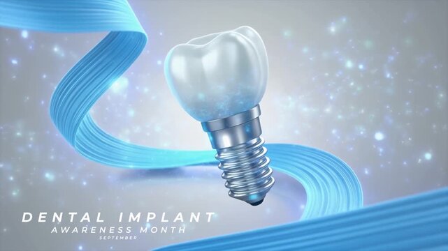Dental Implant Awareness Month Healthy Smile and Tooth Replacement Education. Animation Video
