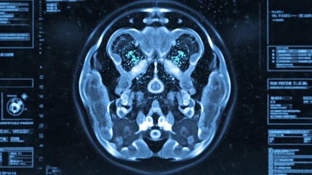 Magnetic resonance imaging brain scan abstract digital wave glowing sphere dark blue tunnel medical display anatomy diagnostic interface futuristic data visualization research laboratory scan image