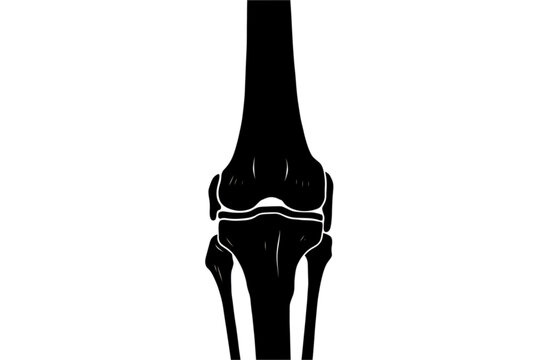 Knee Joint Anatomy Silhouette: A stark black and white depiction of a knee joint, ideal for medical or educational uses, emphasizing key skeletal structures.