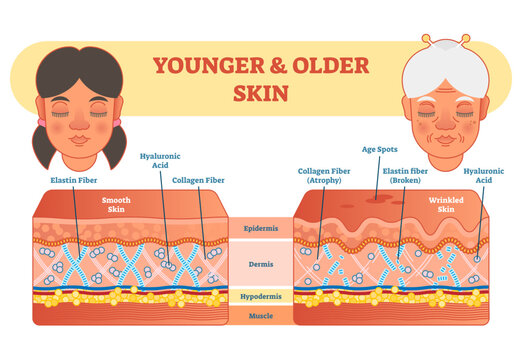 Older and younger skin comparison diagram, illustration scheme, young girl and older lady face, transparent background.