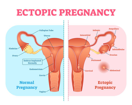 Female sexual cycle illustration graphic diagram with menstruation and ovulation chart and uterus visualizations, transparent background.