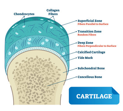 Cartilage illustration, transparent background. Medical scheme of chondrocytes, collagen fibers, calcified cartilage, tide mark, subchondral and cancellous bone. Diagram of superficial.