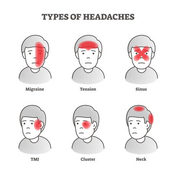 Types of headaches illustration, transparent background. Labeled educational brain pain set. Various health problem with facial migraine, tension, sinus, TMJ, cluster and neck zones symptom.