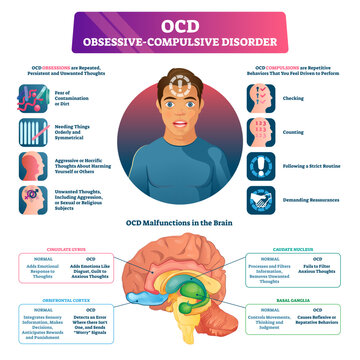 OCD obsessive compulsive disorder labeled explanation illustration, transparent background. Medical disorder and mental illness infographic with symptoms.