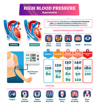 High blood pressure illustration, transparent background. Labeled systole explanation scheme. Medical hypertension HBP condition with persistently elevated arteries.