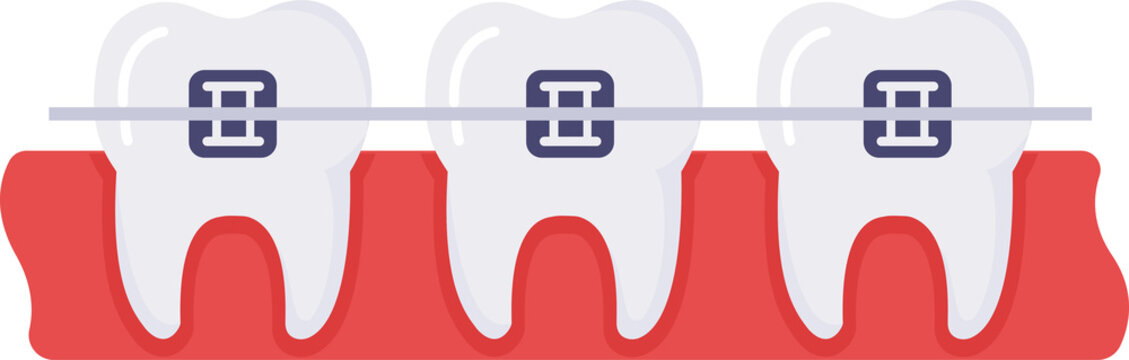 Illustration depicts healthy teeth undergoing orthodontic treatment with silver brackets, wire for straightening, gumline visible.
