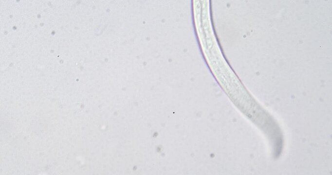 Microscopic nematode worm moving under microscope