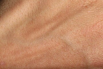 Fototapeta premium Texture of normal skin as background, closeup