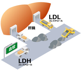 LDLとLDH © トムセン少佐