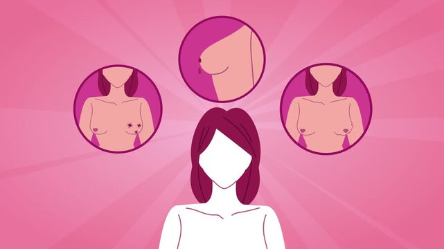 Woman medical illustration showing different types of breast cancer symptoms loopable animation.