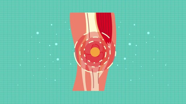 Medical footage showing human elbow joint with pain and inflammation, highlighting red area with pulsing circles, conceptual animation for healthcare and medical issues.