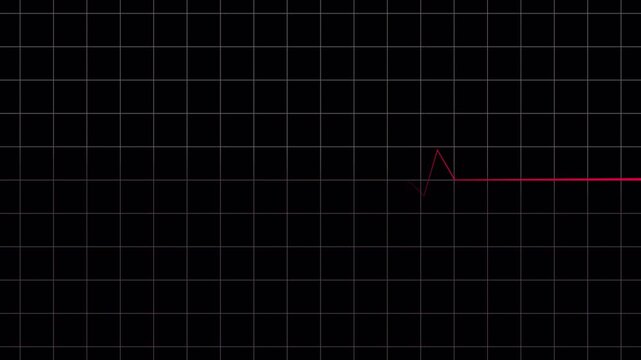Red neon heartbeat ekg pulse line animation on black background, Electrocardiogram heart monitor graph showing abnormal erratic rhythms and flatline effect.