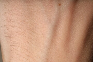 Naklejka premium Texture of normal skin as background, closeup