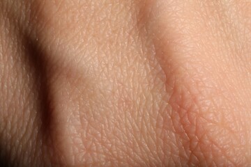 Fototapeta premium Texture of normal skin as background, closeup