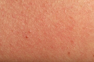 Fototapeta premium Texture of normal skin as background, closeup