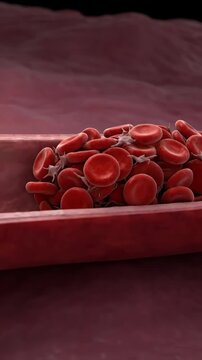 Circulatory danger threat: clot formation, blood vessel, restrict flow, internal blockage, medical risk, thrombus develop, cellular aggregate, health complication.