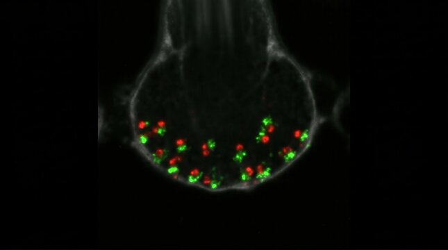 Zebrafish Lateral Line Hair Cell Ribbon Synapse Confocal