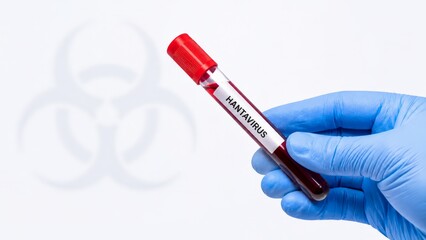 Obraz premium Medical test tube placed near biohazard warning symbol representing dangerous viral infections and laboratory research. Concept of epidemiology, contamination and healthcare safety.